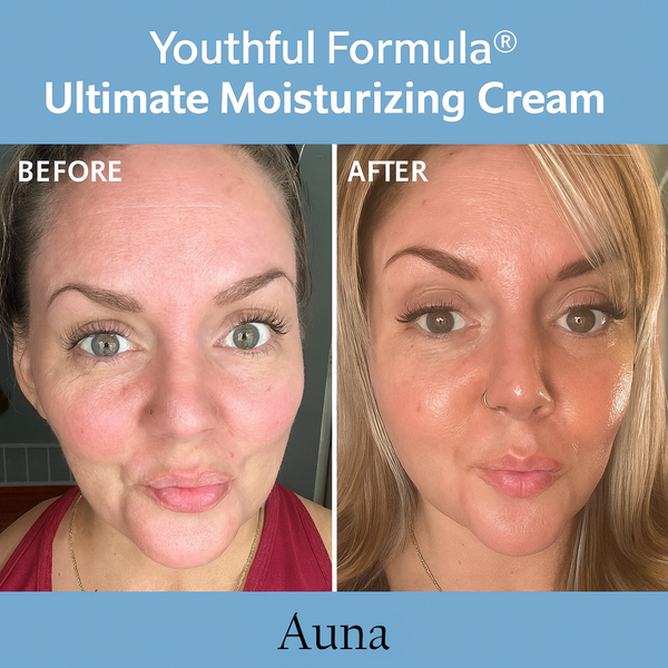 AUNA Youthful Glow Cream – Deep Hydration & Skin Renewal (100mL)