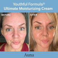 AUNA Youthful Glow Cream – Deep Hydration & Skin Renewal (100mL)